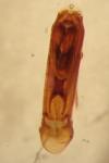 Margarinotus obscurus