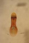 Bisnius fimetarius
