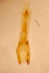 Epuraea melanocephala