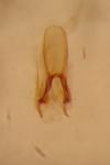 Contacyphon coarctatus