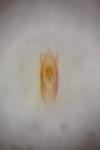 Stenus aceris