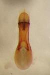 Bisnius fimetarius