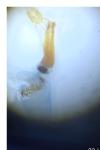 Dioryctria simplicella