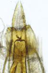 Coleophora sylvaticella