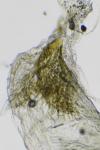 Stigmella ruficapitella