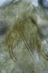 Stigmella ruficapitella
