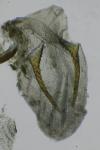 Stenoptilia bipunctidactyla