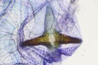 Argyresthia spinosella