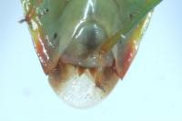 Elasmostethus interstinctus