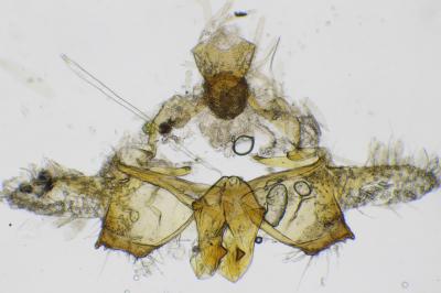 <i>Coleophora otidipennella</i>